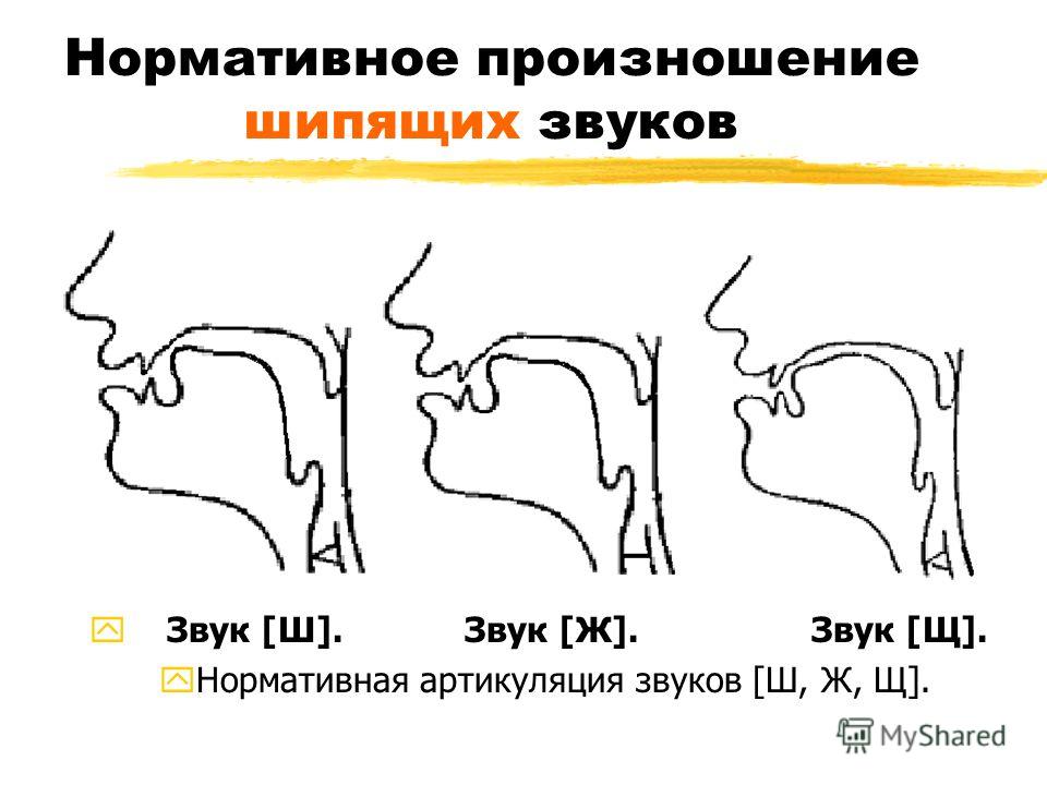 Постановка звука с поэтапно Постановка звука с поэтапно