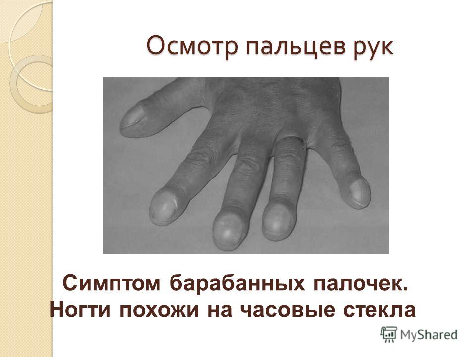 Пальцы и ногти как барабанные палочки Пальцы и ногти как барабанные палочки