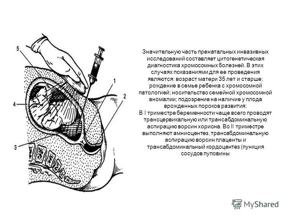 Боль в пояснице и правом боку у женщин