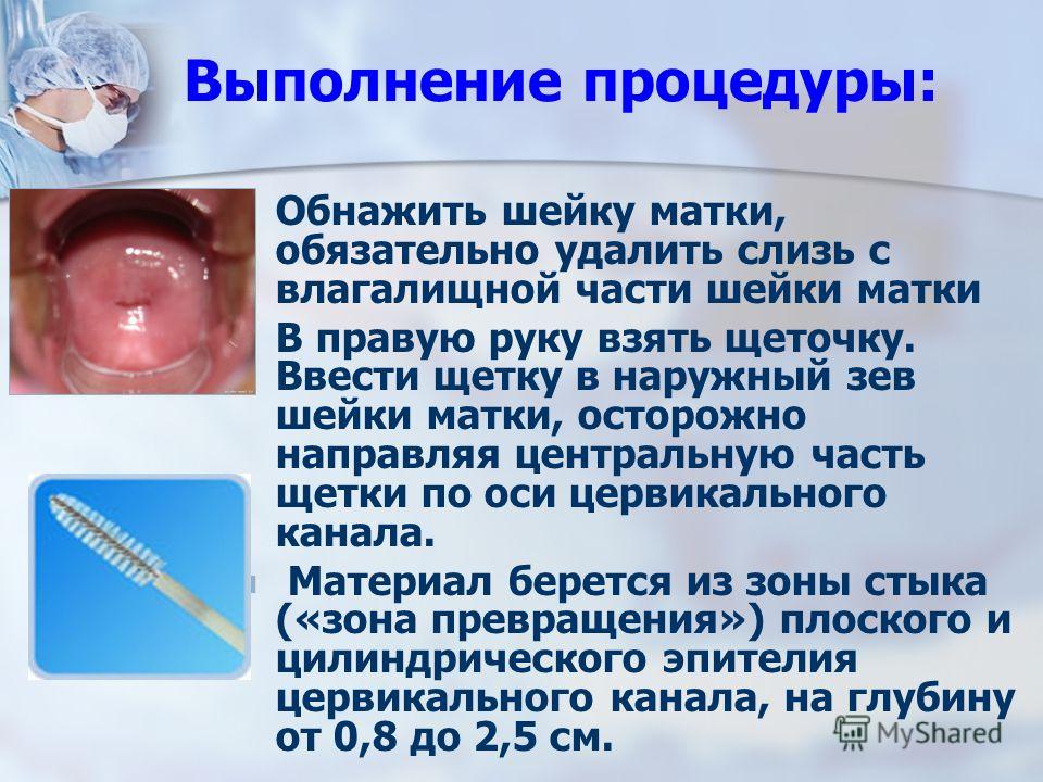 Что показывает анализ на онкоцитологию в гинекологии