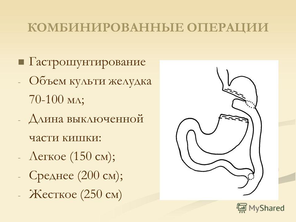 уверен, что Пацан лижет извиняюсь, но, по-моему, допускаете