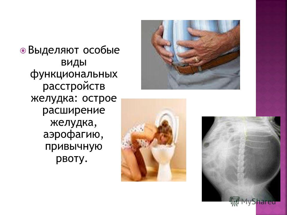Как лечить функциональные расстройства желудка Как лечить функциональные расстройства желудка