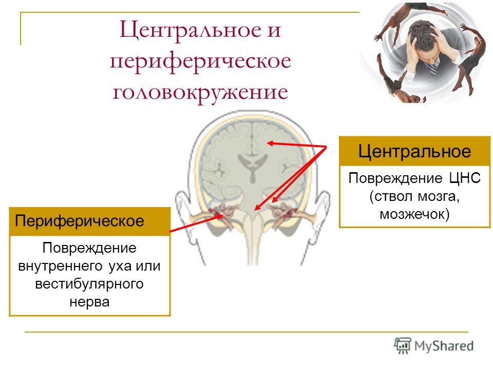 частые головокружения и нарушение сна частые головокружения и нарушение сна