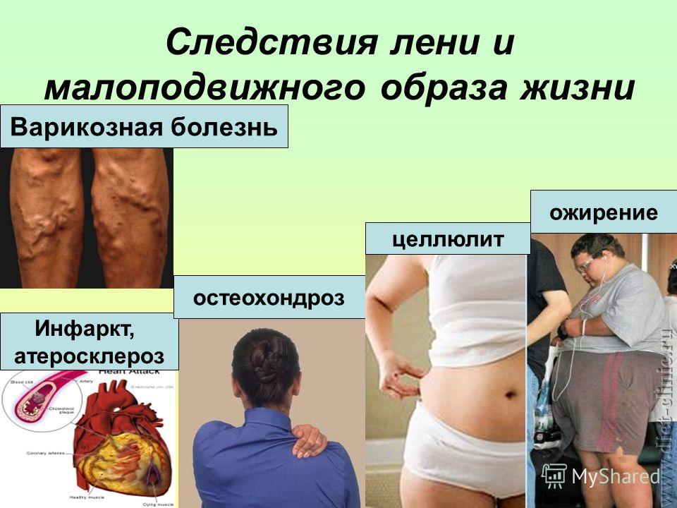 Ожирение и остеохондроз Ожирение и остеохондроз