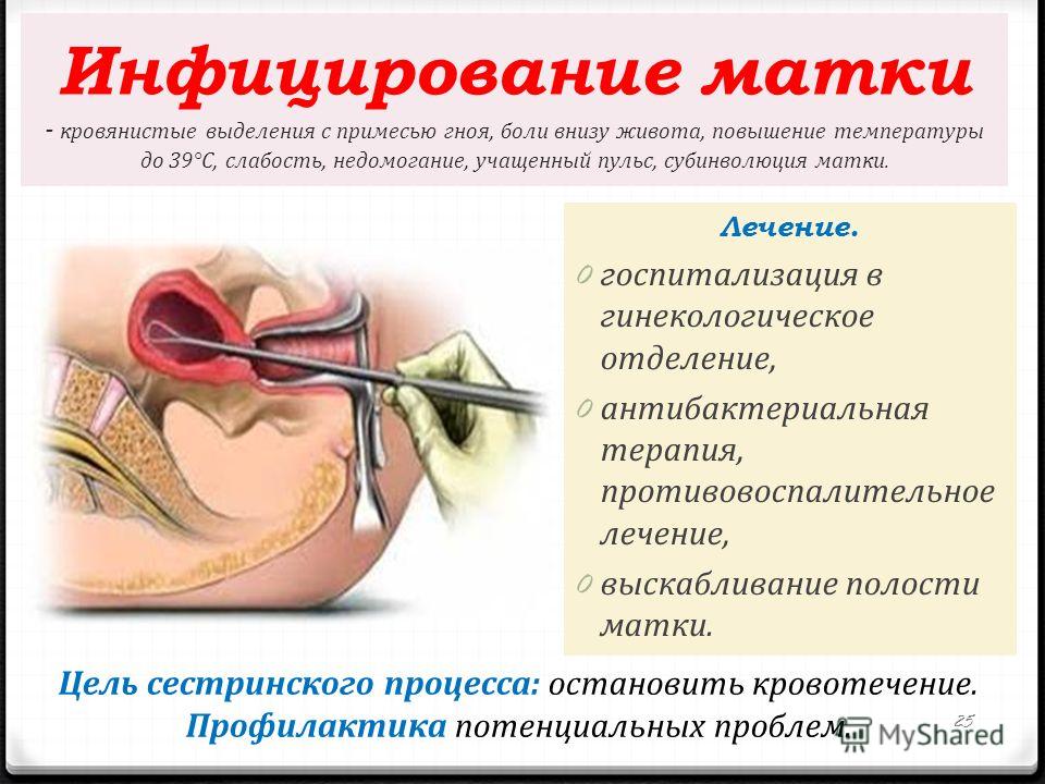 Когда беременна матка пульсирует 45