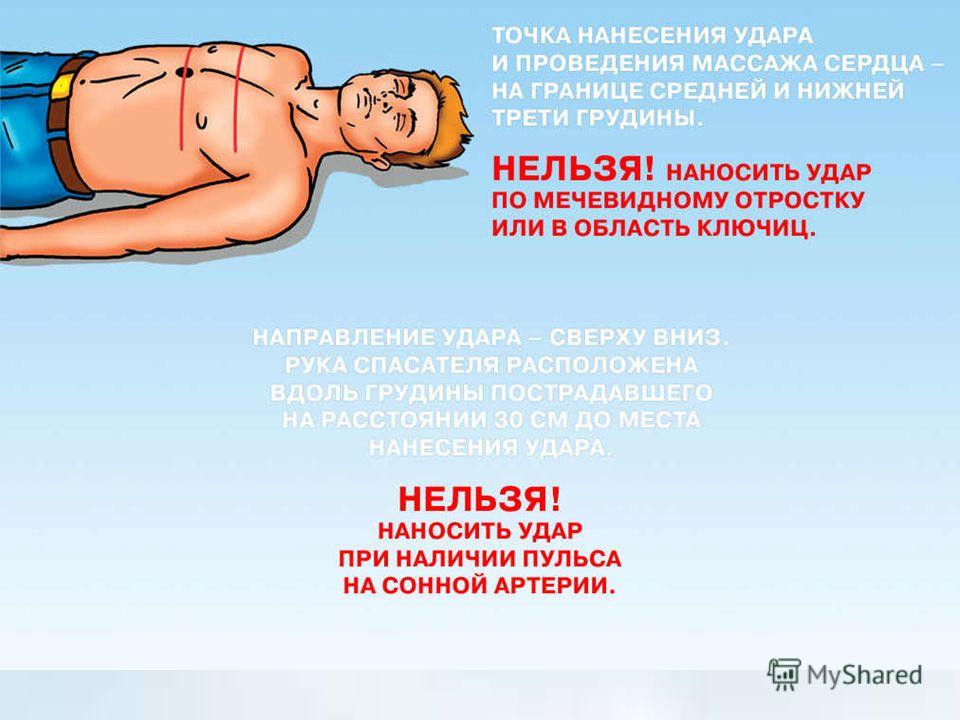 Последовательность действий при массаже Последовательность действий при массаже