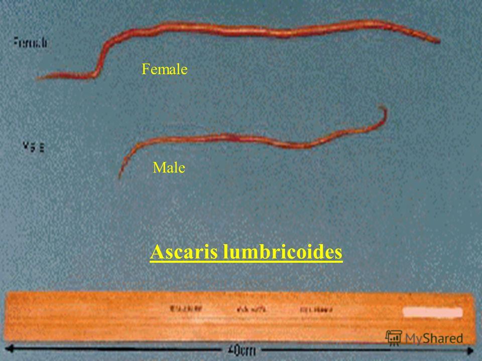 Ascaris lumbricoides Female Male
