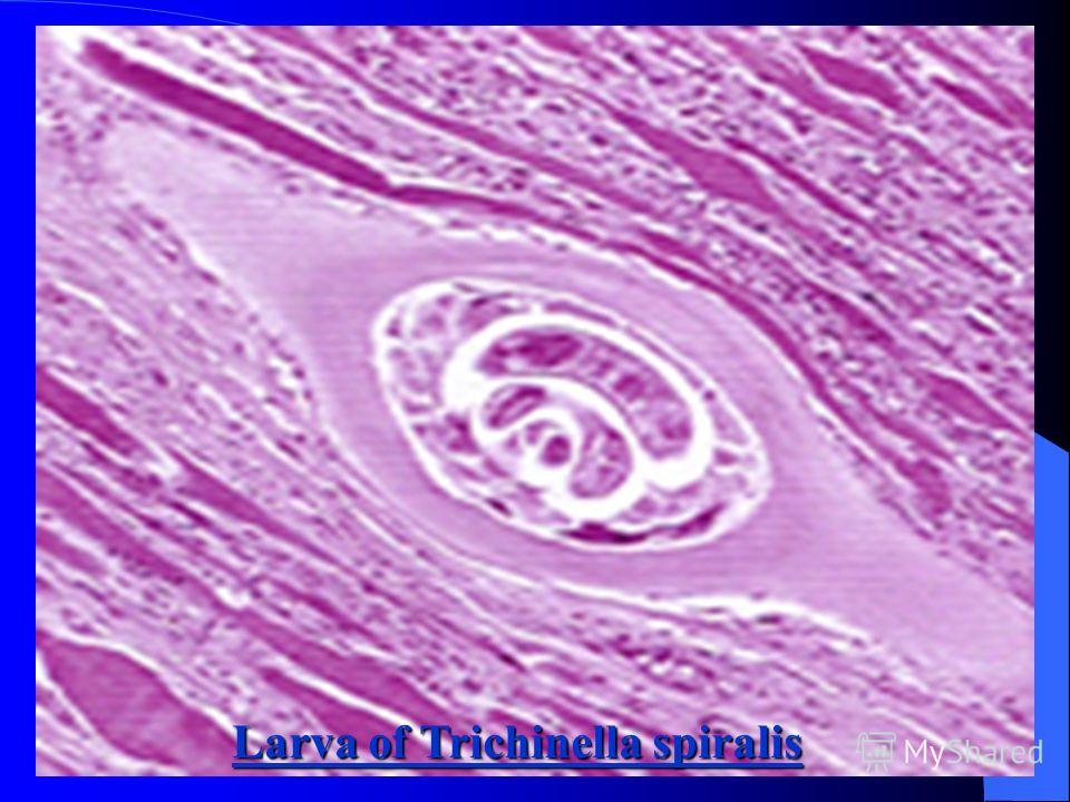 Larva of Trichinella spiralis