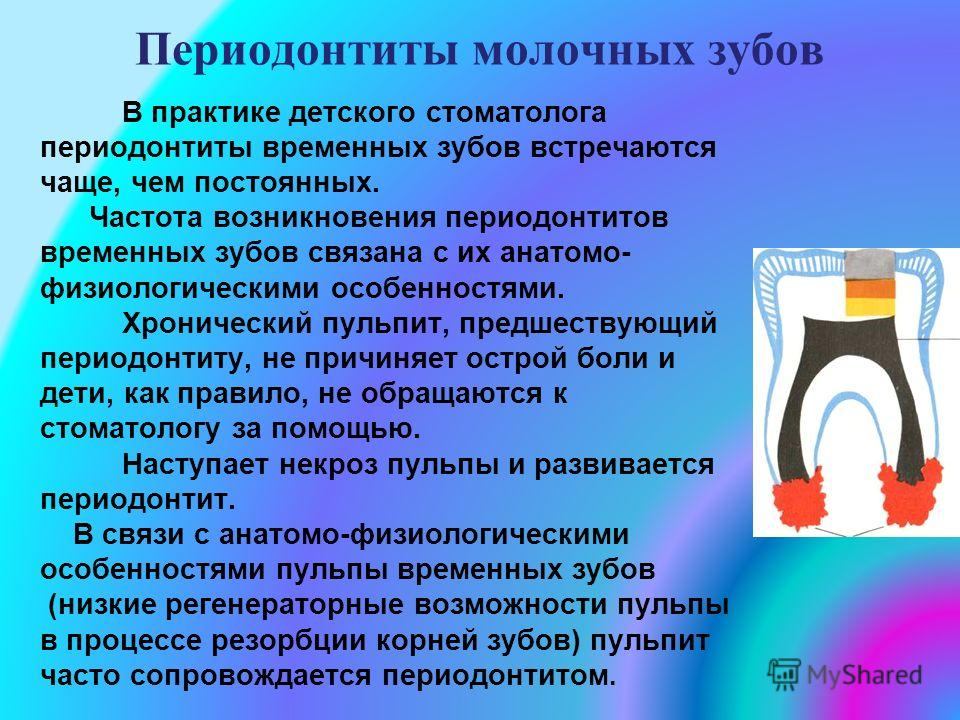 Дифференциальная диагностика периодонтитов временных зубов Дифференциальная диагностика периодонтитов временных зубов
