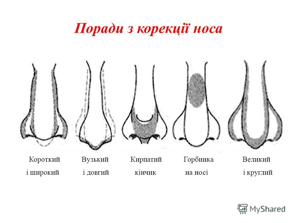 Поради з корекції носа Короткий Вузький Кирпатий Горбинка Великий і широкий і довгий кінчик на носі і круглий