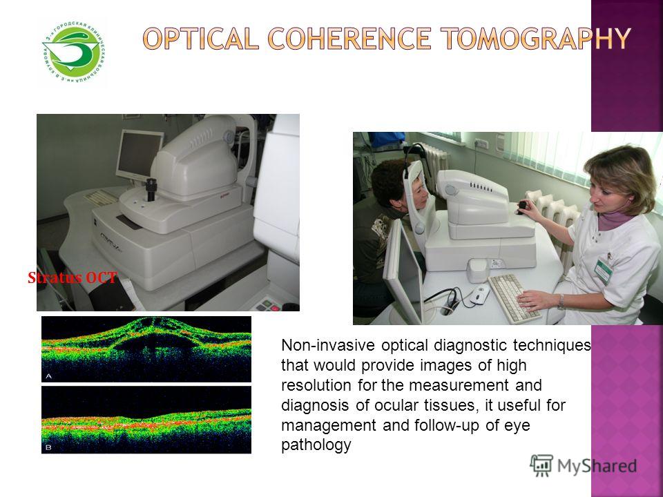 Stratus OCT Non-invasive optical diagnostic techniques that would provide images of high resolution for the measurement and diagnosis of ocular tissues, it useful for management and follow-up of eye pathology