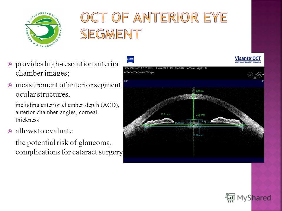 provides high-resolution anterior chamber images; measurement of anterior segment ocular structures, including anterior chamber depth (ACD), anterior chamber angles, corneal thickness allows to evaluate the potential risk of glaucoma, complications f