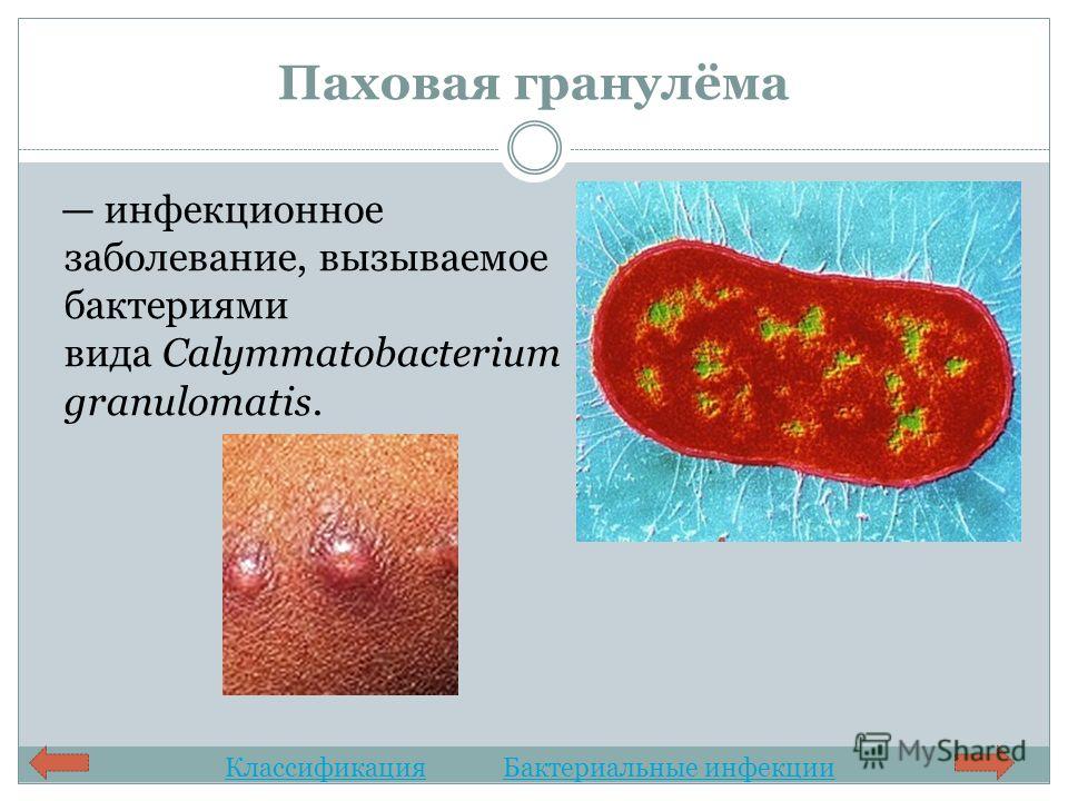 Паховая гранулёма инфекционное заболевание, вызываемое бактериями вида Calymmatobacterium granulomatis. КлассификацияБактериальные инфекции
