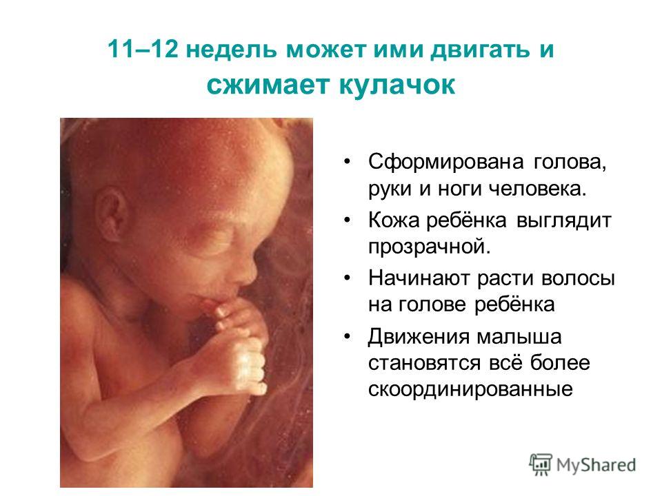 11–12 недель может ими двигать и сжимает кулачок Сформирована голова, руки и ноги человека. Кожа ребёнка выглядит прозрачной. Начинают расти волосы на голове ребёнка Движения малыша становятся всё более скоординированные