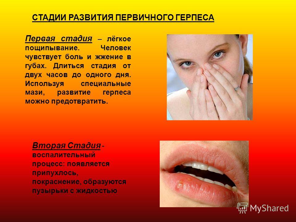 Боль и выделения из уретры