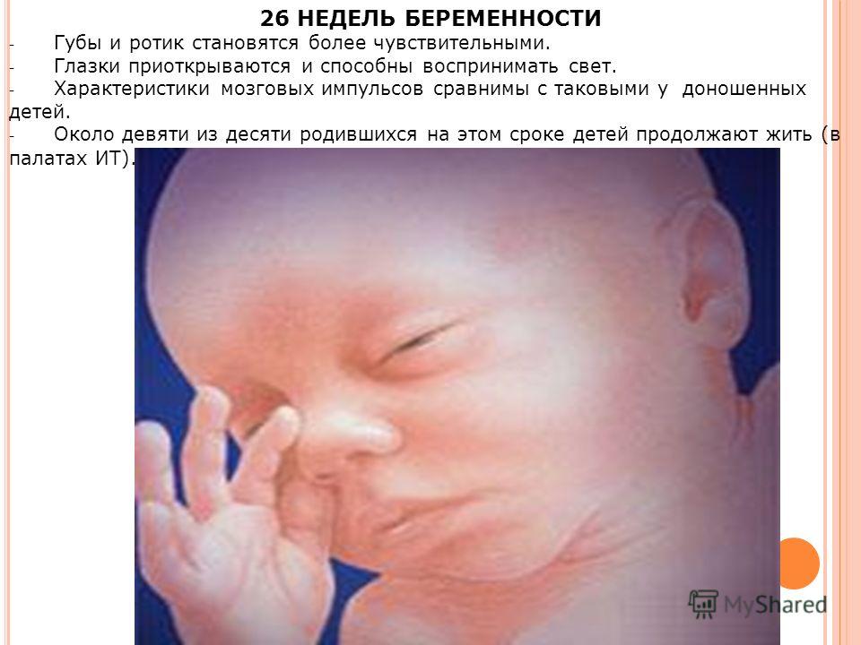 Фото плода на 26 неделе беременности