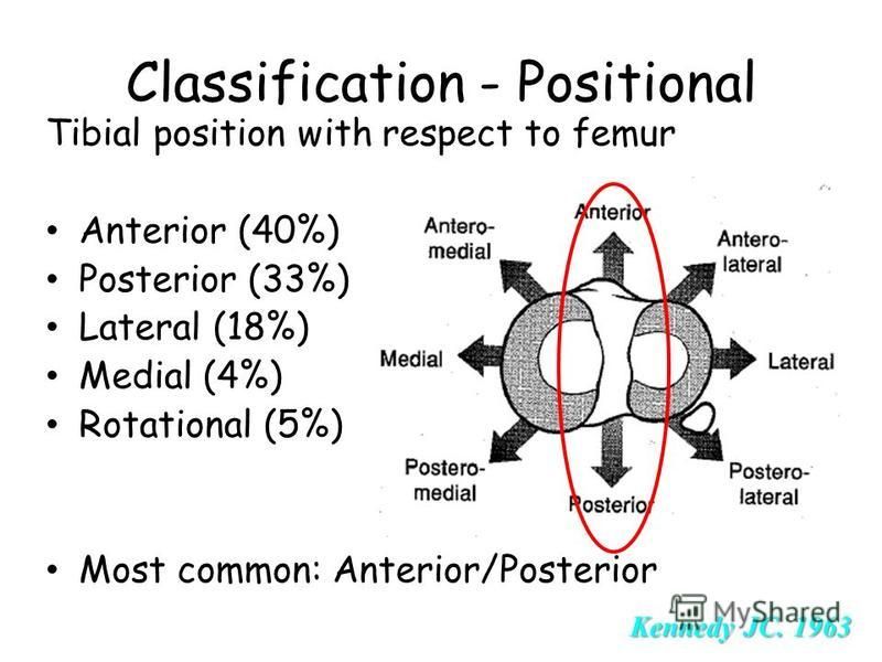 Презентация на тему "Knee Dislocation KazNMU 2 топ. Anatomy