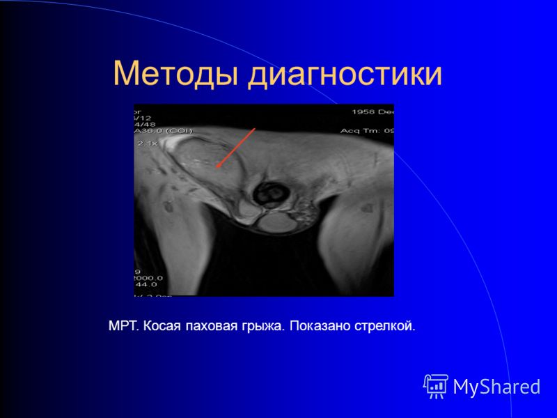 Во сне болеет дочка