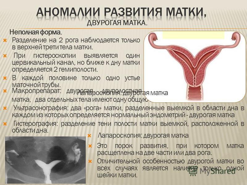 Как забеременеть при двурогой матке