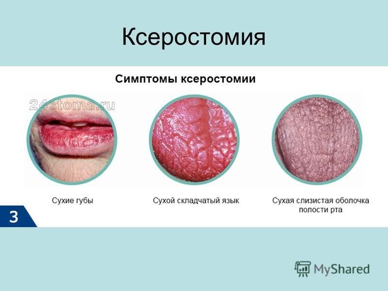 Герниопластика (грыжесечение) - что это такое, операция, цены, видео ГОСТ РВ 8.560 -95 Государственная система обеспечения единства измерений