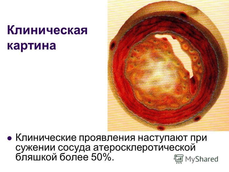 Как расшифровать анализ крови холестерин