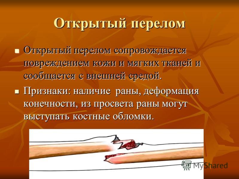 Перелом ноги больница
