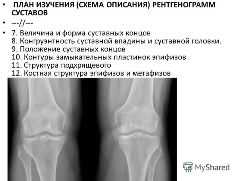 Костно суставная система