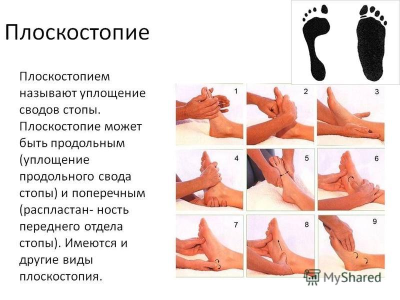 Массаж для стоп ребенку при плоскостопии Массаж для стоп ребенку при плоскостопии