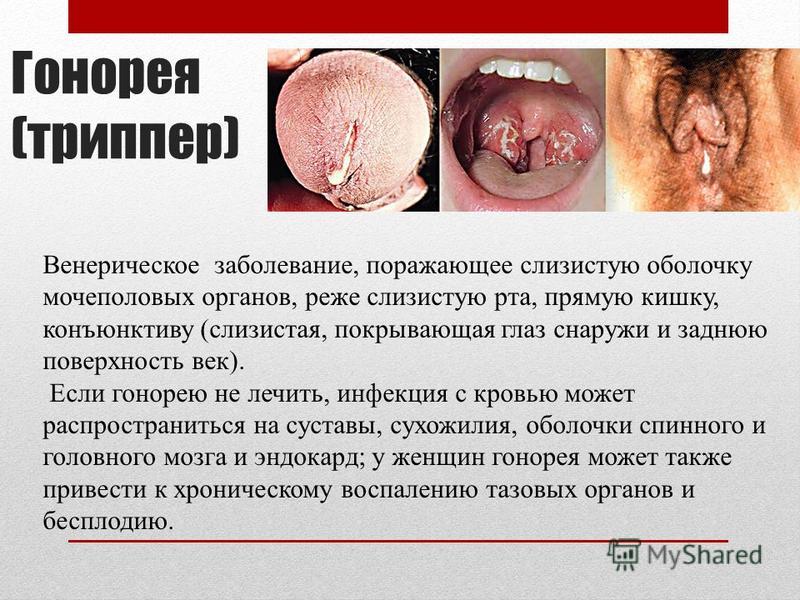 Как лечить венерологические заболевания у мужчин в домашних условиях Как лечить венерологические заболевания у мужчин в домашних условиях
