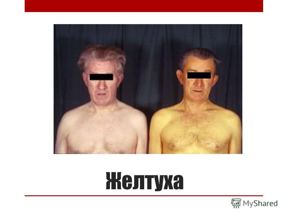 Боль в животе как от пресса