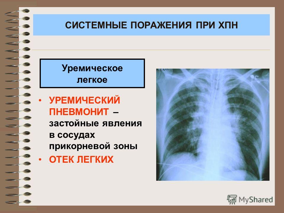 запах изо рта диарея запах изо рта диарея