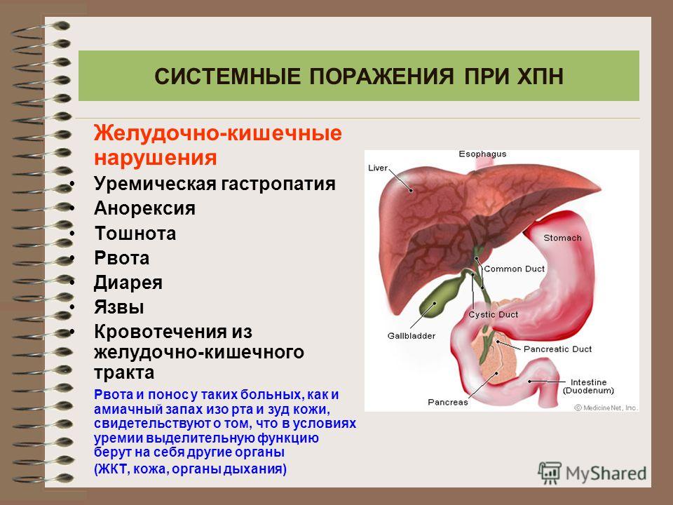 перекись от глистов отзывы перекись от глистов отзывы