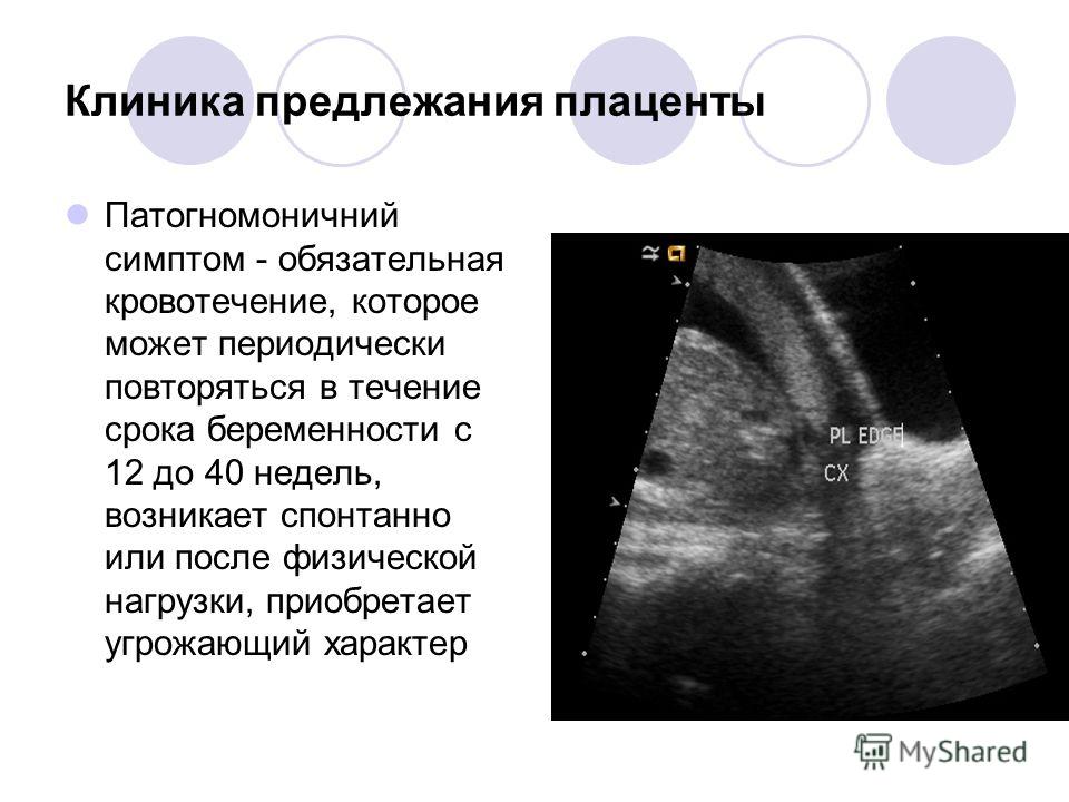 Помогаю от болей спины