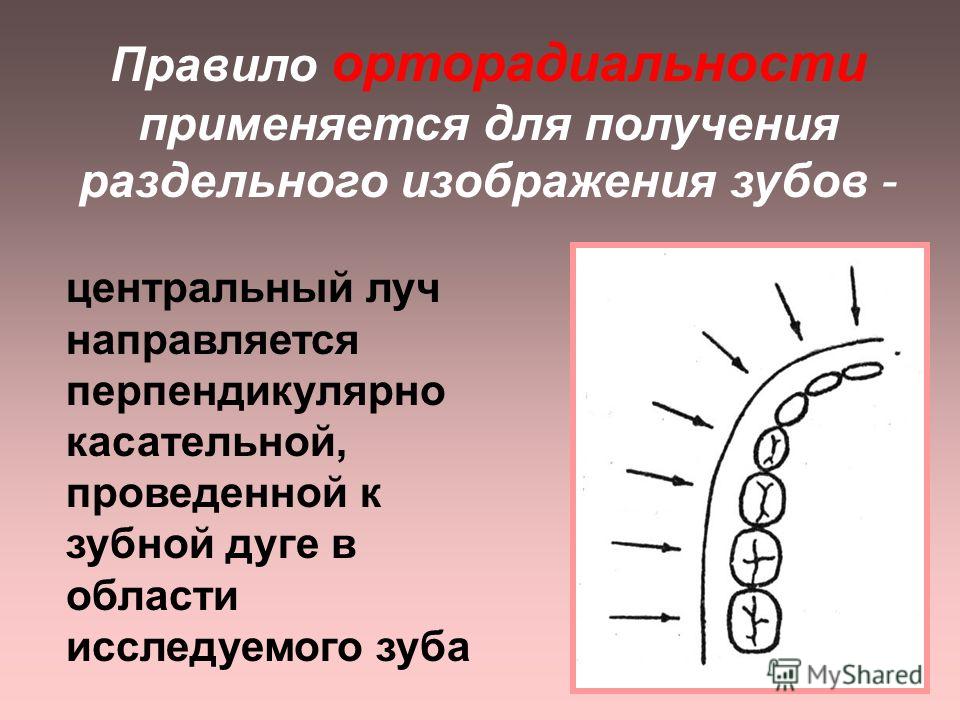 Шкала размера зубов Шкала размера зубов