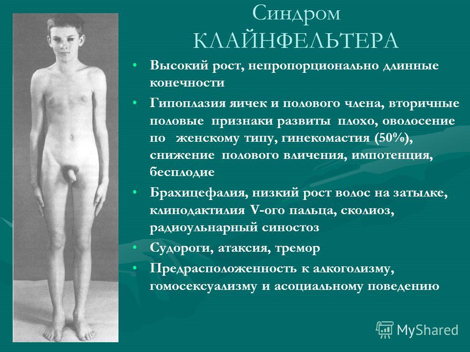 Гиперпигментация кожи голеней Гиперпигментация кожи голеней