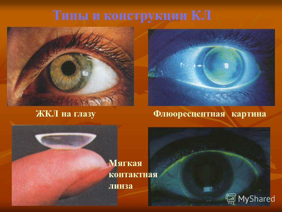 Черника форте купить москва