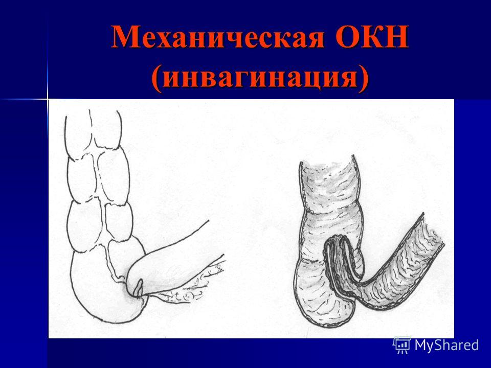 медикаменты от паразитов в организме человека медикаменты от паразитов в организме человека