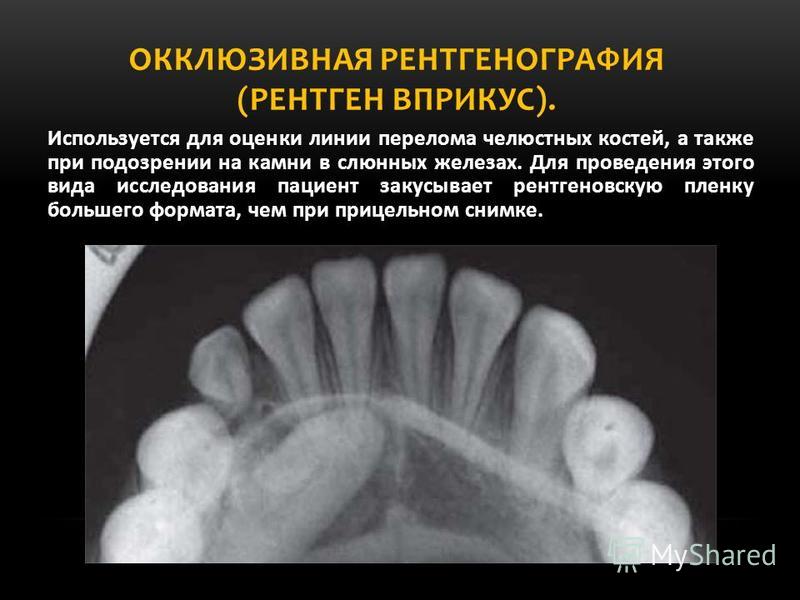 Рентгенография в стоматологии учебник