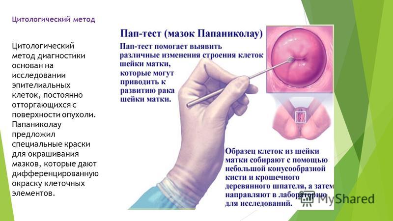 Анализ в гинекологии на онкологию