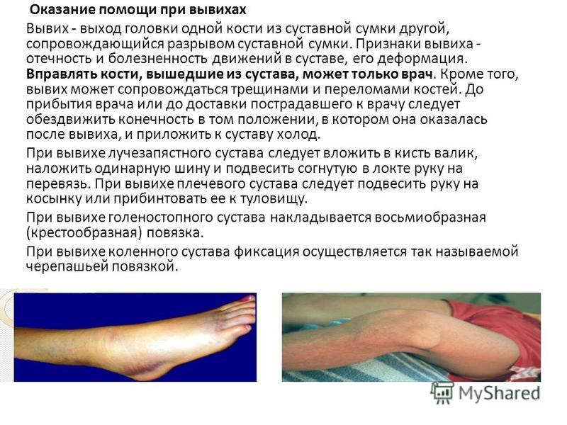 При переломе какой кости необходимо обездвижить 3 сустава комплекс упражнений для разработки локтевого сустава после вывиха