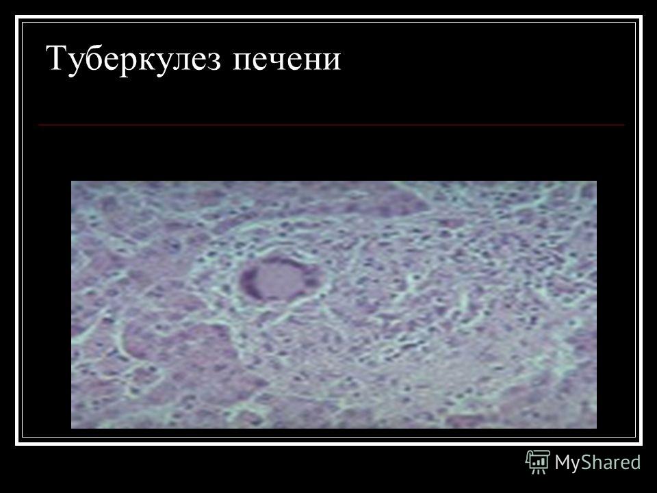 Страх это болезнь лечение