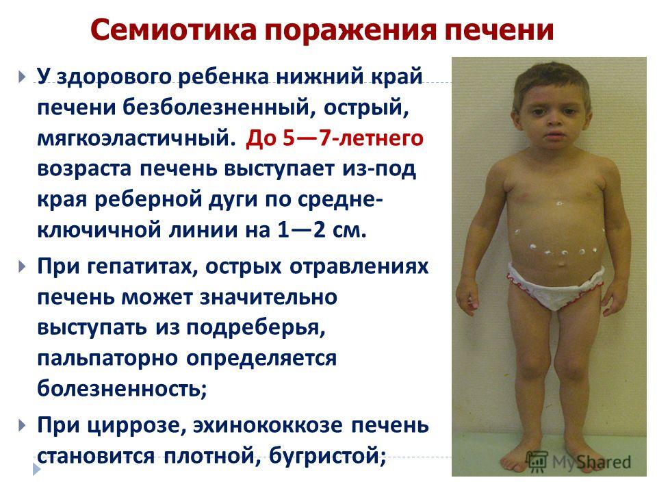 как вывести запах изо рта от алкоголя как вывести запах изо рта от алкоголя