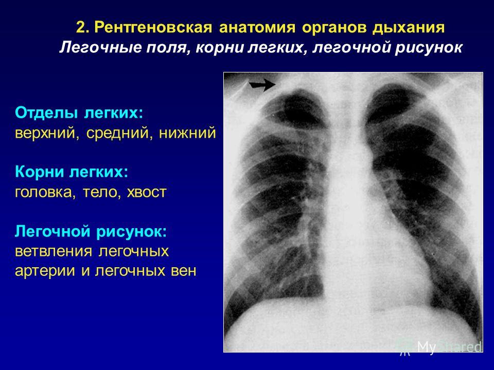 Сегментарное строение легких схема фото 436