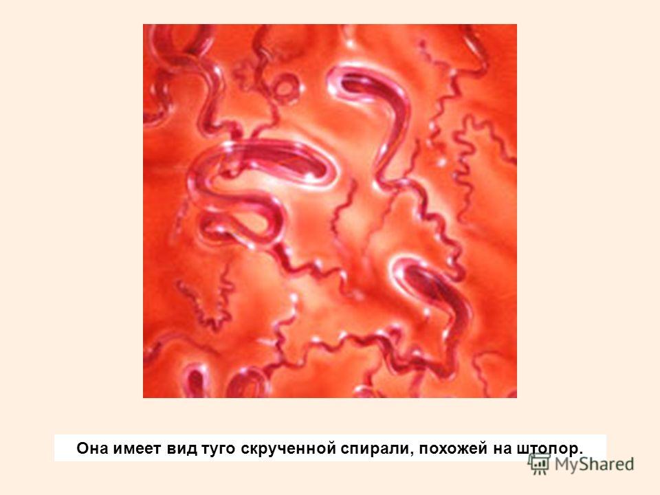 Заболевание передающееся через кожу Заболевание передающееся через кожу