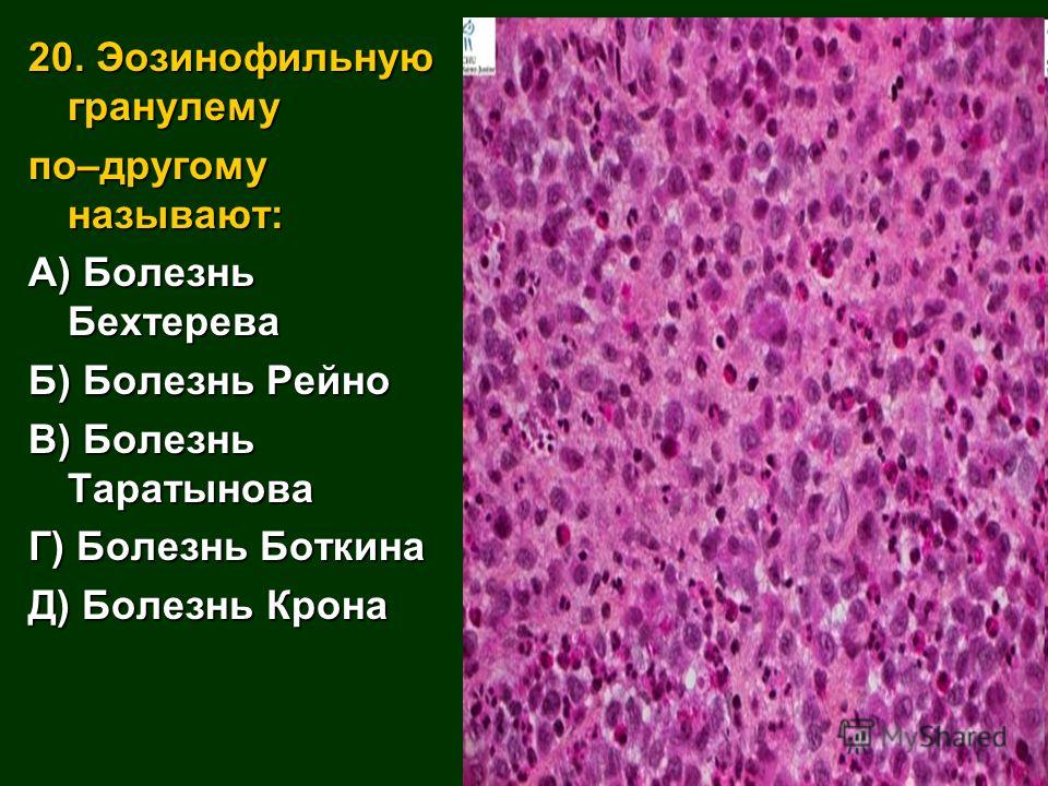 История болезни лошади острое расширение желудка