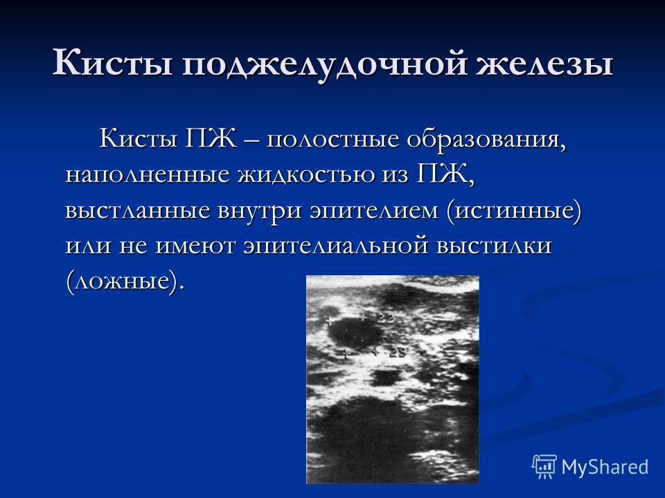 Болит внизу живота и вздутие живота у женщин