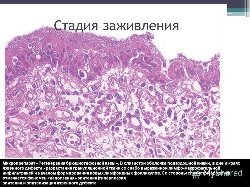 Грануляционная ткань - Студопедия