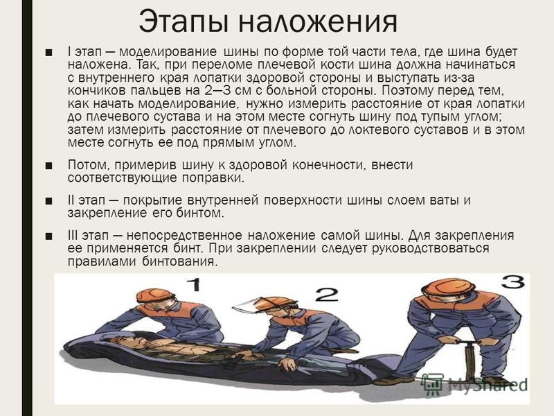 Шинные повязки. Правила наложения транспортных шин. Шинные повязки. Правила наложения транспортных шин.