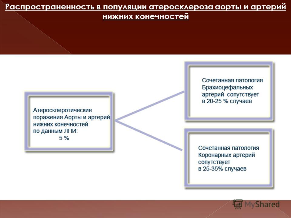фак асс