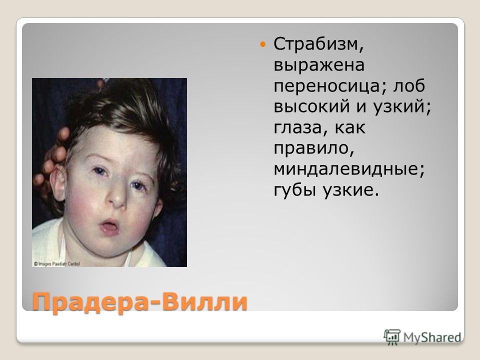 Нарушение расположения зубов Протокол ведения больных Кариес зубов от г